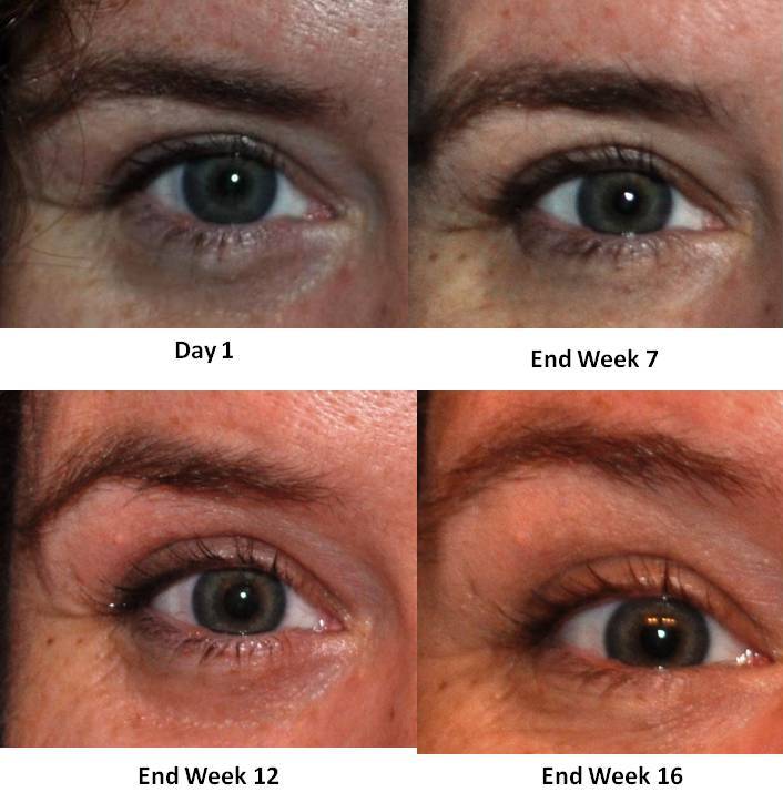 Health & Beauty "Eye" See a Difference After Using Fysiko Lash Growth